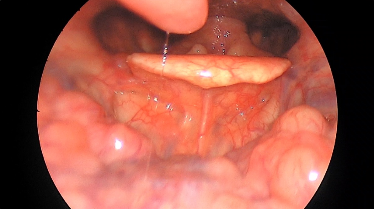 Endoscopy live feed